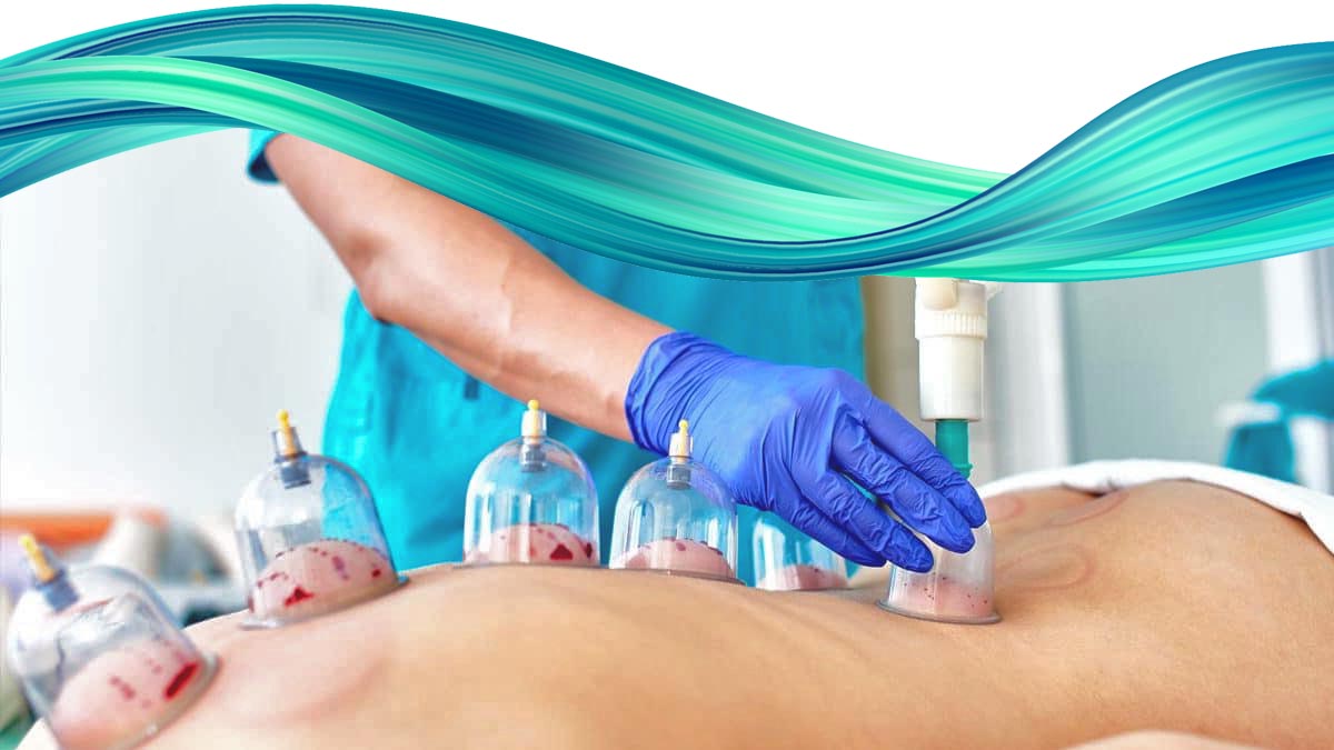 hijama london